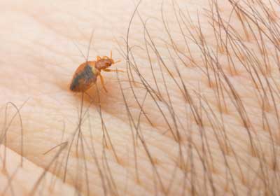 Do bed bugs bite? | Des Moines IA | Springer Professional Home Services