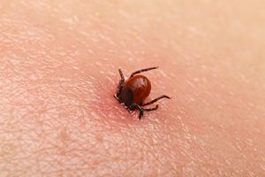 tick in skin in Des Moines, IA | Springer Professional Home Solutions